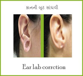 Wisdom Tooth Removal In Mehsana